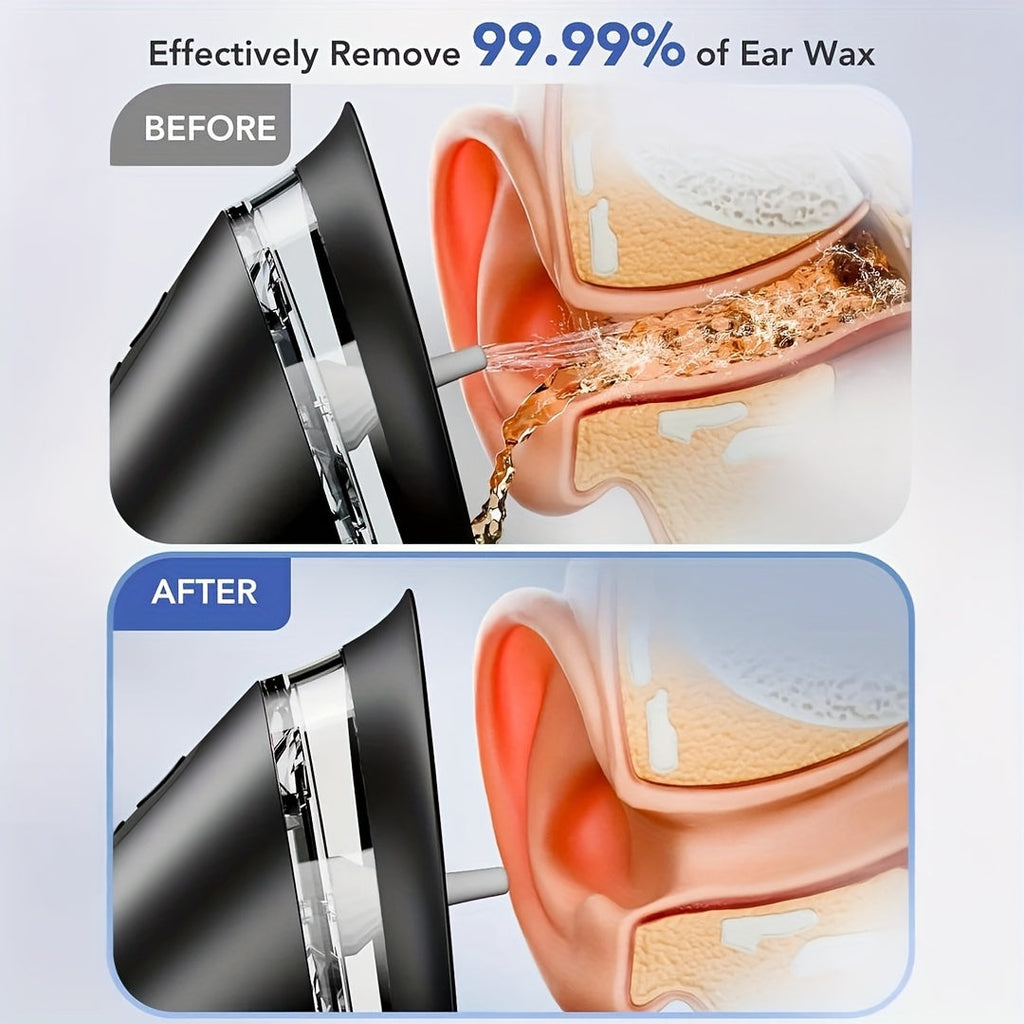Electric USB Rechargeable Earwax Removal Cleaner Tool