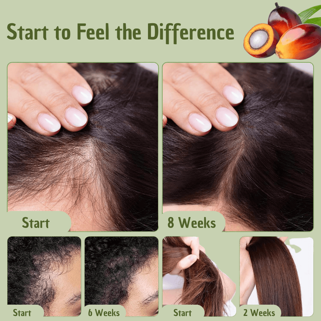 Hair Oil Natural Hair Care Treatment