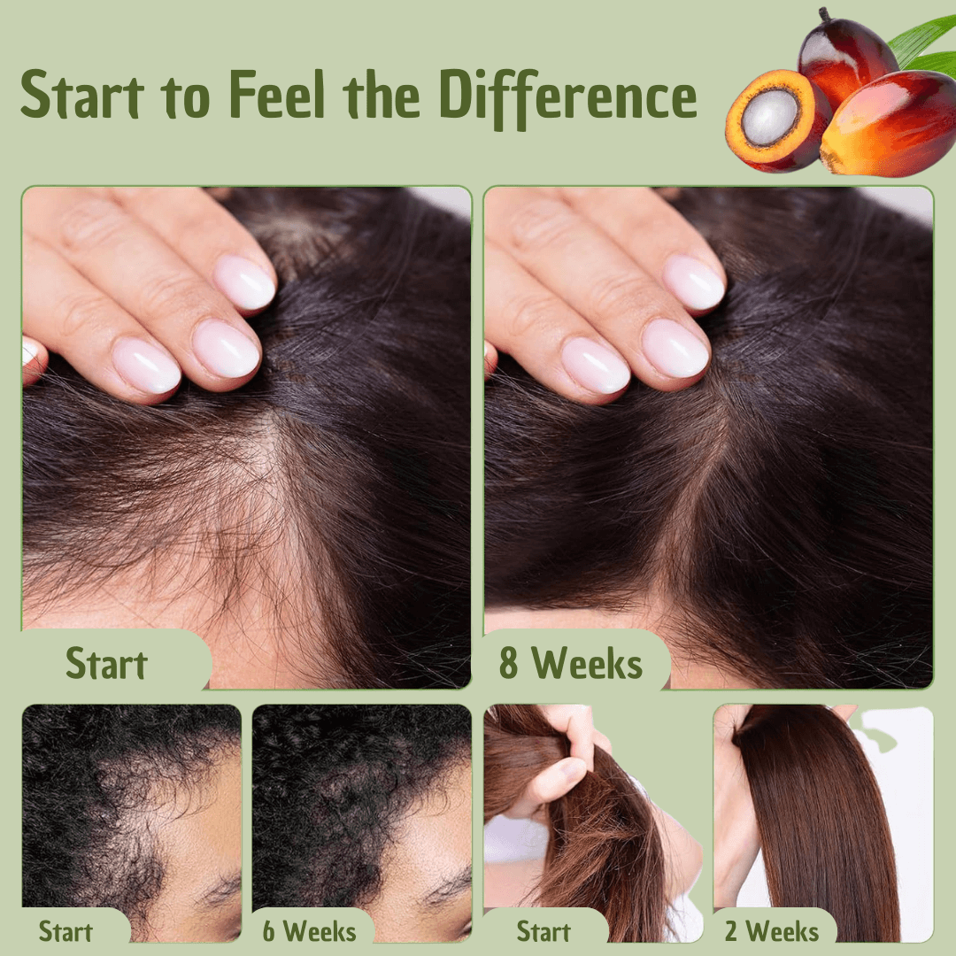 Hair Oil Natural Hair Care Treatment