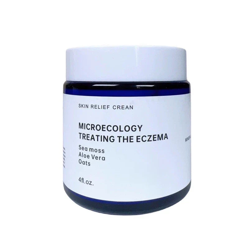 Eczema Relief Cream for Irritated Skin Soothing Treatment